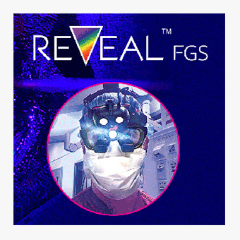 Reveal FGS